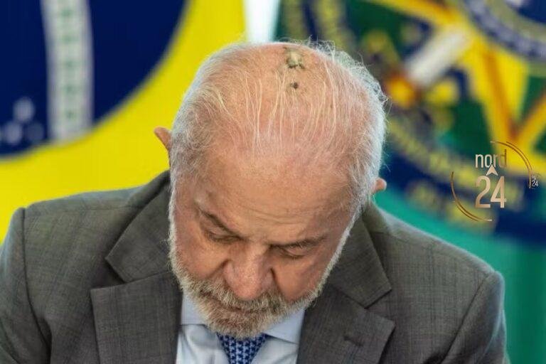 Lula inició radioterapia tras cirugía en la cabeza en Brasil