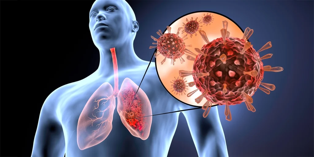 Infecciones respiratorias: ¿Cómo prevenirlas este invierno?