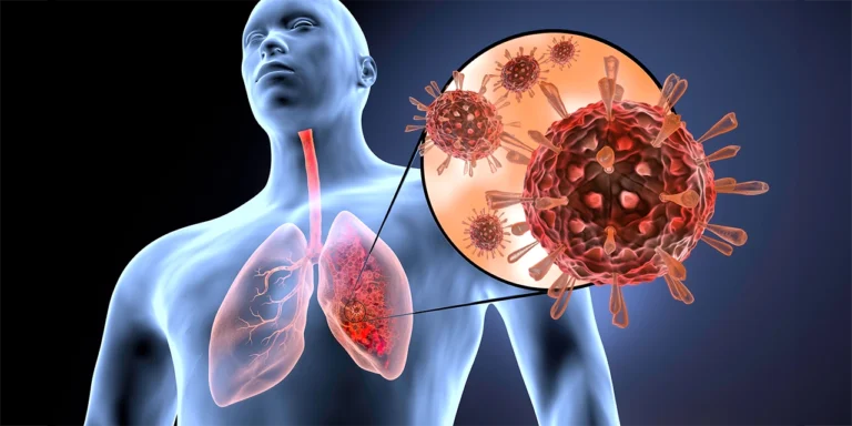 Infecciones respiratorias: ¿Cómo prevenirlas este invierno?